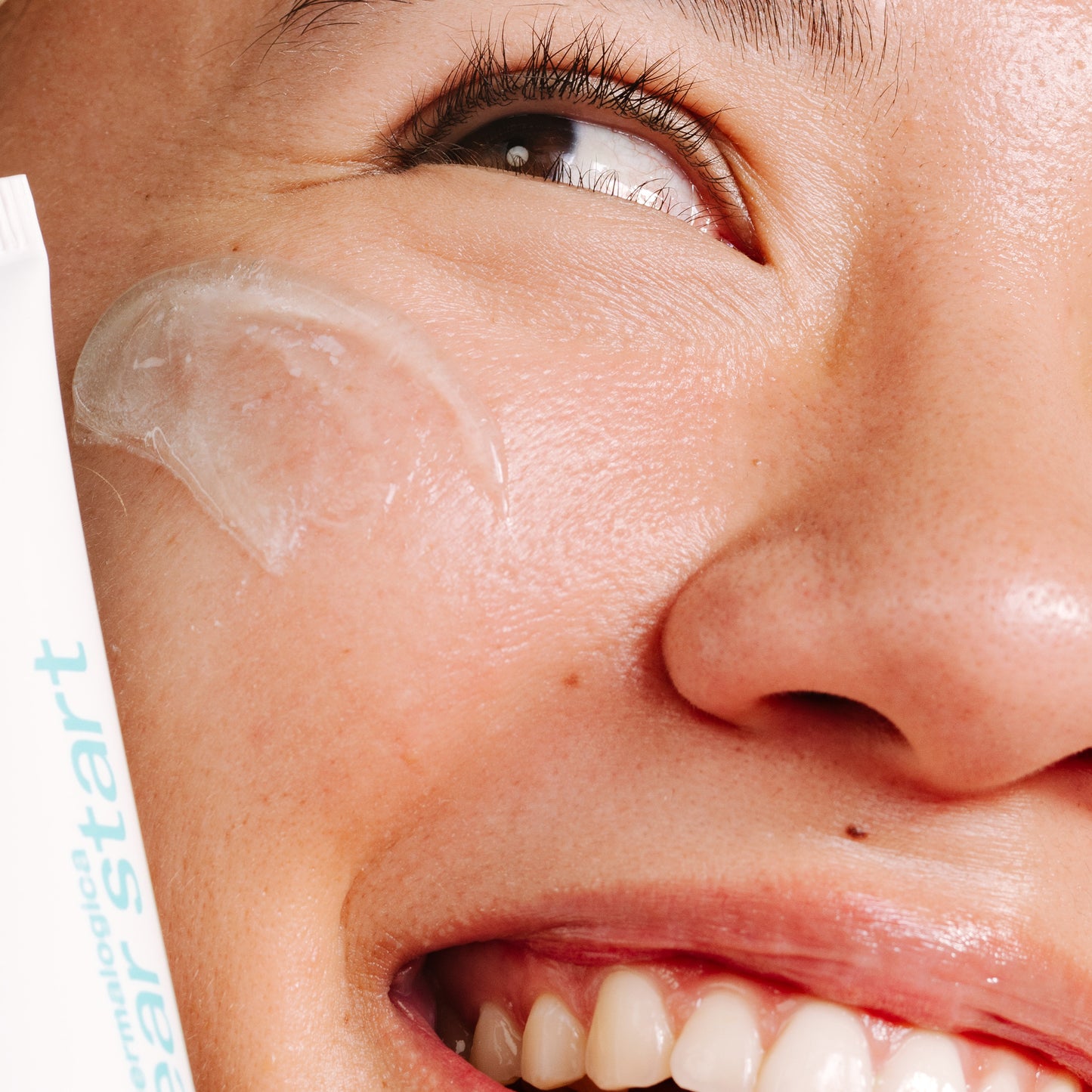 breakout clearing kit