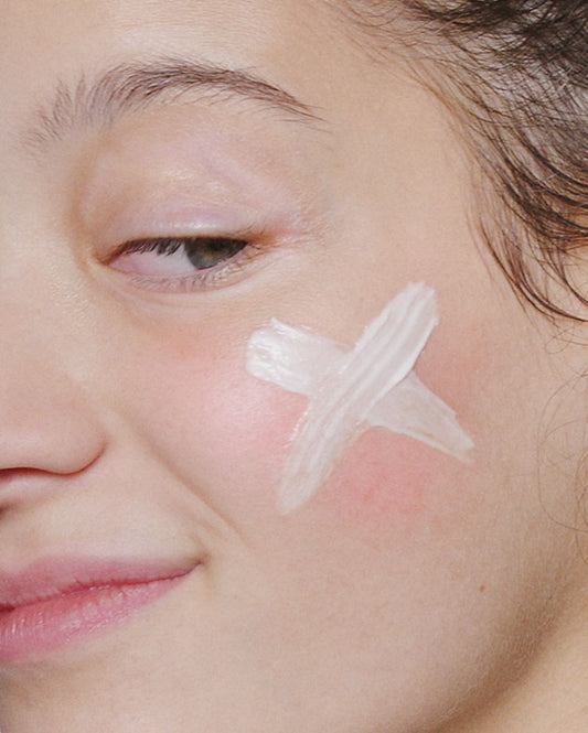 Poškodovana barriera kože lahko povzroči občutljivo kožo