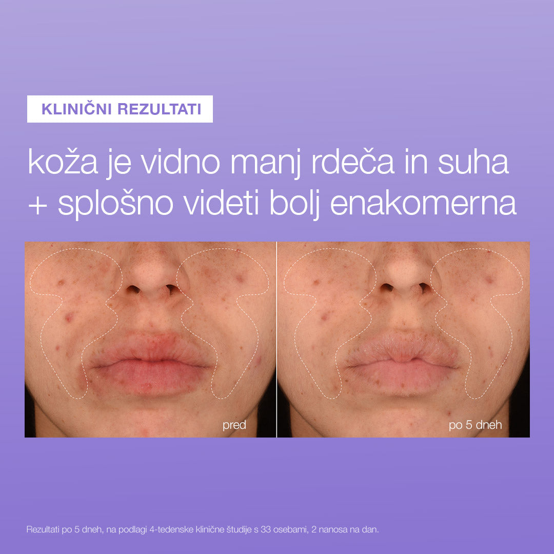 stabilizing repair serum